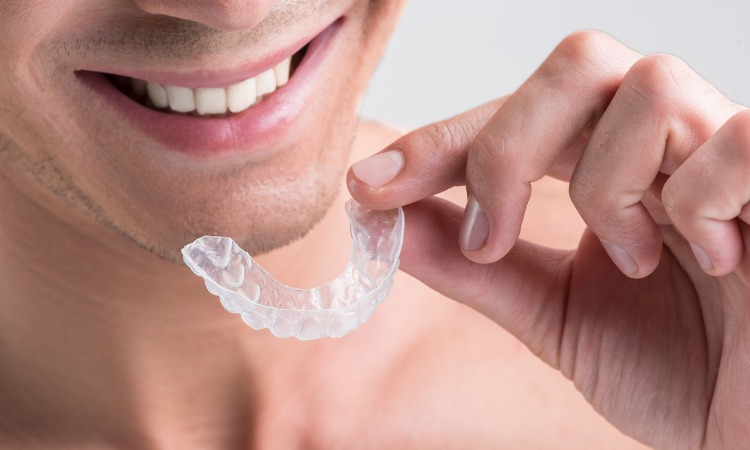 Getting braces as an adult what to expect - Notting Hill Dentist Number 18 Dental